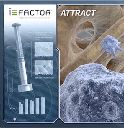 cerapedics ifactor cerapedics ifactor